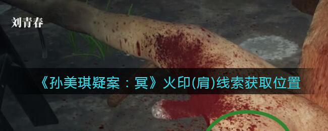 《孙美琪疑案：冥》四级线索——火印（肩）